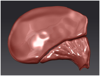 Bioform of Temporal Muscle Custom bioform of temporal muscle for soft-tissue prosthesis with cell seeding