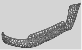 3D Scaffold for Mandible Reconstruction Lattice implant for lower jawbone regeneration and structural support